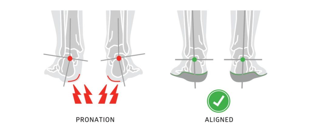 Was-ist-Fußpronation